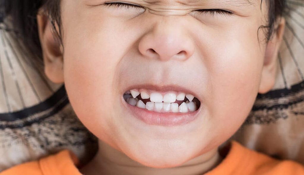 5-Year-Old Grinding Their Teeth